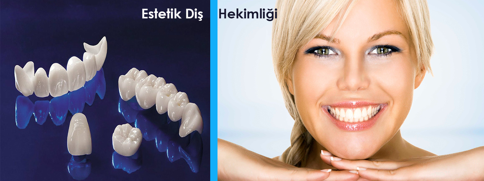dentalkoza tuzla
